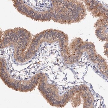 Anti-NUDCD2 antibody produced in rabbit Prestige Antibodies&#174; Powered by Atlas Antibodies, affinity isolated antibody, buffered aqueous glycerol solution