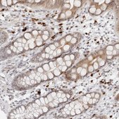 Anti-ZNF678 antibody produced in rabbit Prestige Antibodies® Powered by Atlas Antibodies, affinity isolated antibody, buffered aqueous glycerol solution