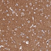 Anti-MIGA2 antibody produced in rabbit Prestige Antibodies® Powered by Atlas Antibodies, affinity isolated antibody, buffered aqueous glycerol solution