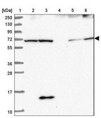 Anti-SDCCAG8 antibody produced in rabbit Prestige Antibodies&#174; Powered by Atlas Antibodies, affinity isolated antibody, buffered aqueous glycerol solution