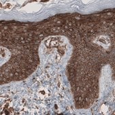 Monoclonal Anti-CARS antibody produced in mouse Prestige Antibodies&#174; Powered by Atlas Antibodies, clone CL2304, purified immunoglobulin, buffered aqueous glycerol solution