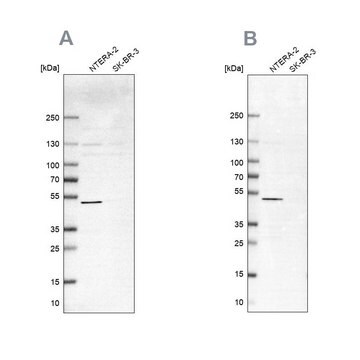 Anti-IST1 antibody produced in rabbit Prestige Antibodies&#174; Powered by Atlas Antibodies, affinity isolated antibody, buffered aqueous glycerol solution