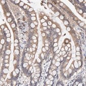 Anti-SGPL1 antibody produced in rabbit Prestige Antibodies&#174; Powered by Atlas Antibodies, affinity isolated antibody, buffered aqueous glycerol solution