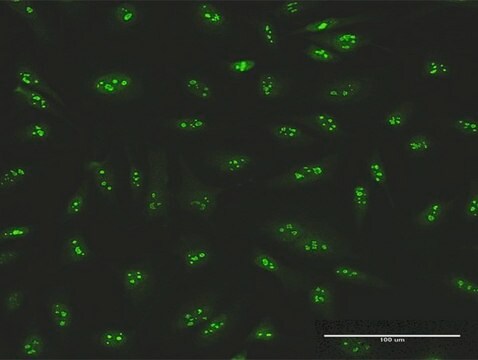 Anti-SMARCA5 antibody produced in rabbit purified immunoglobulin, buffered aqueous solution