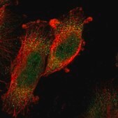 Anti-MAPKAPK5 antibody produced in rabbit Prestige Antibodies&#174; Powered by Atlas Antibodies, affinity isolated antibody, buffered aqueous glycerol solution
