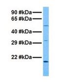 Anti-HERV-FRD, (N-terminal) antibody produced in rabbit affinity isolated antibody