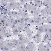Anti-ARSG antibody produced in rabbit Prestige Antibodies&#174; Powered by Atlas Antibodies, affinity isolated antibody, buffered aqueous glycerol solution, Ab1