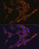 Anti-AGR2 antibody produced in rabbit