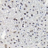 Anti-Phospho-ERK1-T202 + ERK2-T185 antibody produced in rabbit