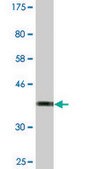 Monoclonal Anti-TOPORS antibody produced in mouse clone 5G9, ascites fluid, solution