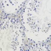 Anti-DiMethyl-Histone H4-K20 antibody produced in rabbit