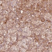 Anti-SPATA2L antibody produced in rabbit Prestige Antibodies&#174; Powered by Atlas Antibodies, affinity isolated antibody, buffered aqueous glycerol solution