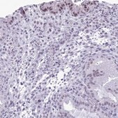 Anti-DHX40 antibody produced in rabbit Prestige Antibodies&#174; Powered by Atlas Antibodies, affinity isolated antibody, buffered aqueous glycerol solution