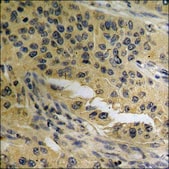 Anti-phospho-B-RAF (pSer602) antibody produced in rabbit affinity isolated antibody