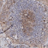 抗-CASP3 兔抗 Prestige Antibodies&#174; Powered by Atlas Antibodies, affinity isolated antibody, buffered aqueous glycerol solution