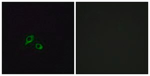 Anti-GIPR antibody produced in rabbit affinity isolated antibody