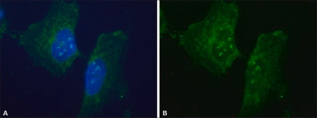 Anti-Dopamine Transporter (N-terminal) antibody produced in rabbit ~1.0&#160;mg/mL, affinity isolated antibody, buffered aqueous solution