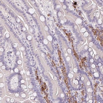 Anti-ZNF215 antibody produced in rabbit Prestige Antibodies&#174; Powered by Atlas Antibodies, affinity isolated antibody, buffered aqueous glycerol solution
