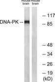 Anti-Dynamin-1 antibody produced in rabbit affinity isolated antibody