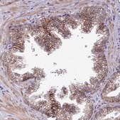 Anti-SLC39A6 antibody produced in rabbit Prestige Antibodies&#174; Powered by Atlas Antibodies, affinity isolated antibody, buffered aqueous glycerol solution