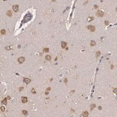 Anti-NMT2 antibody produced in rabbit Prestige Antibodies&#174; Powered by Atlas Antibodies, affinity isolated antibody, buffered aqueous glycerol solution