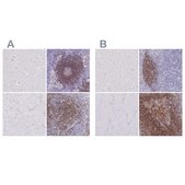 Anti-CD37 antibody produced in rabbit Prestige Antibodies® Powered by Atlas Antibodies, affinity isolated antibody, buffered aqueous glycerol solution