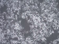 Assay Ready MB49 Mouse Bladder Carcinoma Cell Line