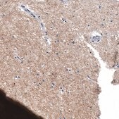 Monoclonal Anti-CHGB antibody produced in mouse Prestige Antibodies&#174; Powered by Atlas Antibodies, clone CL11404, purified immunoglobulin, buffered aqueous glycerol solution