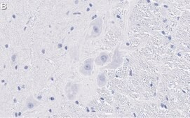 Anti-MRGPRX4 Antibody, clone 3F4 ZooMAb® Rabbit Monoclonal recombinant, expressed in HEK 293 cells