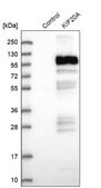 Anti-KIF20A antibody produced in rabbit Prestige Antibodies® Powered by Atlas Antibodies, affinity isolated antibody, buffered aqueous glycerol solution