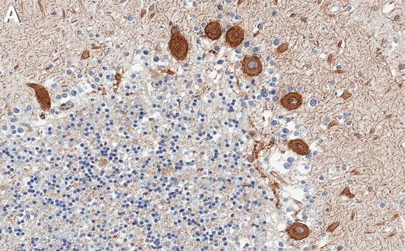 Anti-Maxi K/BK channel Antibody, clone 3D15 ZooMAb&#174; Rabbit Monoclonal recombinant, expressed in HEK 293 cells