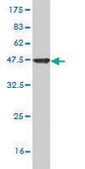 Monoclonal Anti-SAP18 antibody produced in mouse clone 3B2, purified immunoglobulin, buffered aqueous solution