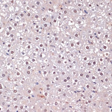 Anti-CDKN2A/p16INK4a antibody produced in rabbit