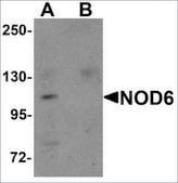 Anti-NOD6 antibody produced in rabbit affinity isolated antibody, buffered aqueous solution