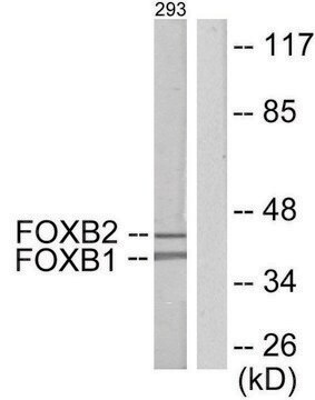 Anti-FOXB1 antibody produced in rabbit affinity isolated antibody