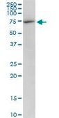 Anti-DDX5 antibody produced in mouse purified immunoglobulin, buffered aqueous solution