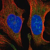 Anti-SUCO antibody produced in rabbit Prestige Antibodies® Powered by Atlas Antibodies, affinity isolated antibody, buffered aqueous glycerol solution
