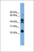Anti-RPE, (N-terminal) antibody produced in rabbit affinity isolated antibody