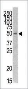 Anti-STK38L (N-term) antibody produced in rabbit IgG fraction of antiserum, buffered aqueous solution