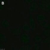 Anti-Rabies glycoprotein Antibody, clone 24-3F-10 ZooMAb® Mouse Monoclonal recombinant, expressed in HEK 293 cells