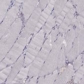 Anti-PAX2 antibody produced in rabbit Prestige Antibodies&#174; Powered by Atlas Antibodies, affinity isolated antibody
