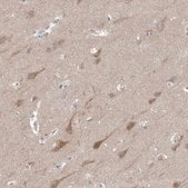 Anti-GPHN antibody produced in rabbit Prestige Antibodies&#174; Powered by Atlas Antibodies, affinity isolated antibody, buffered aqueous glycerol solution