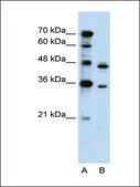 Anti-PRPS2 antibody produced in rabbit affinity isolated antibody