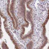 Anti-ATF6B antibody produced in rabbit affinity isolated antibody, buffered aqueous glycerol solution