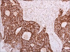 Anti-SLC25A22 antibody produced in rabbit