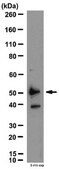 Anti-VPAC2 Antibody from rabbit, purified by affinity chromatography