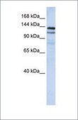 Anti-NOMO1 (ab2) antibody produced in rabbit affinity isolated antibody