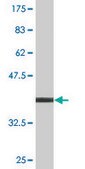 Monoclonal Anti-NCBP1 antibody produced in mouse clone 1E9, purified immunoglobulin, buffered aqueous solution