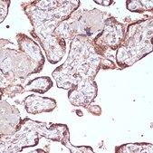 Anti-YAP1 antibody produced in rabbit