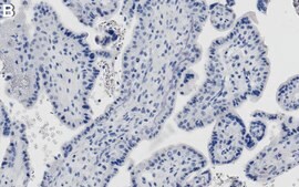 Anti-ATF6&#945; Antibody, clone 1F11 ZooMAb&#174; Rabbit Monoclonal recombinant, expressed in HEK 293 cells